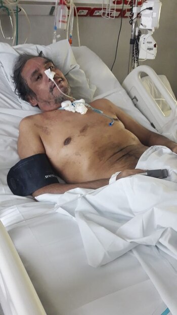 Sufrió todas las complicaciones del