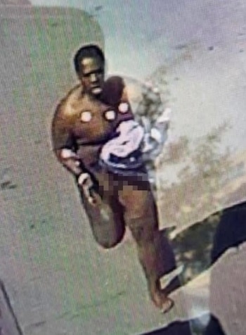 Una persona de tez oscura con el torso desnudo y parches médicos en el pecho, sosteniendo ropa; la parte inferior de su cuerpo está pixelada en una imagen borrosa