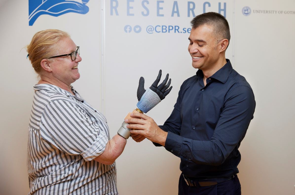 Las primeras manos biónicas comenzaron a desarrollarse en la década de 1960. Hay diferentes modelos (Ortiz-Catalán y otros, Sci. Rob., 2023)