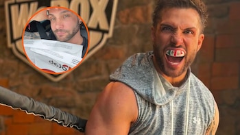 Nicola Porcella revela lesión muscular