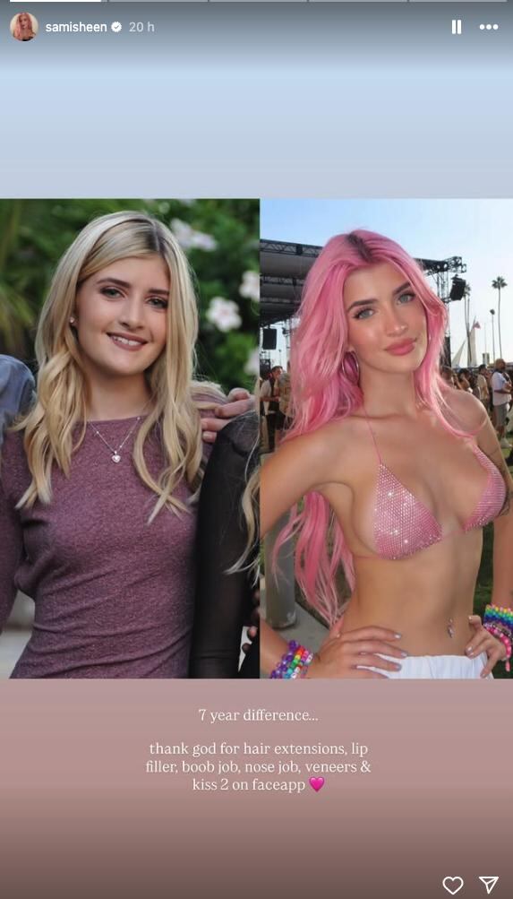 Sami Sheen se mostró orgullosa de su cambio físico gracias a las cirugías plásticas. (Instagram/Sami Sheen)