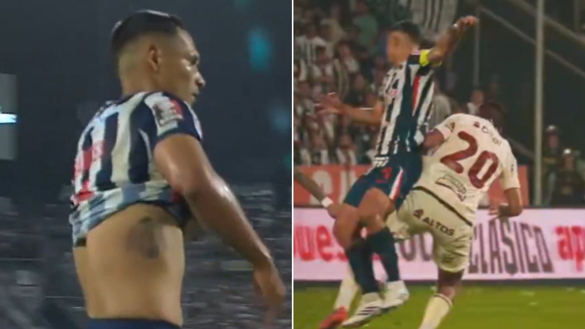 Renzo Garcés mostró la marca que le dejó Alex Valera tras la falta previo al gol de Universitario ante Alianza Lima.