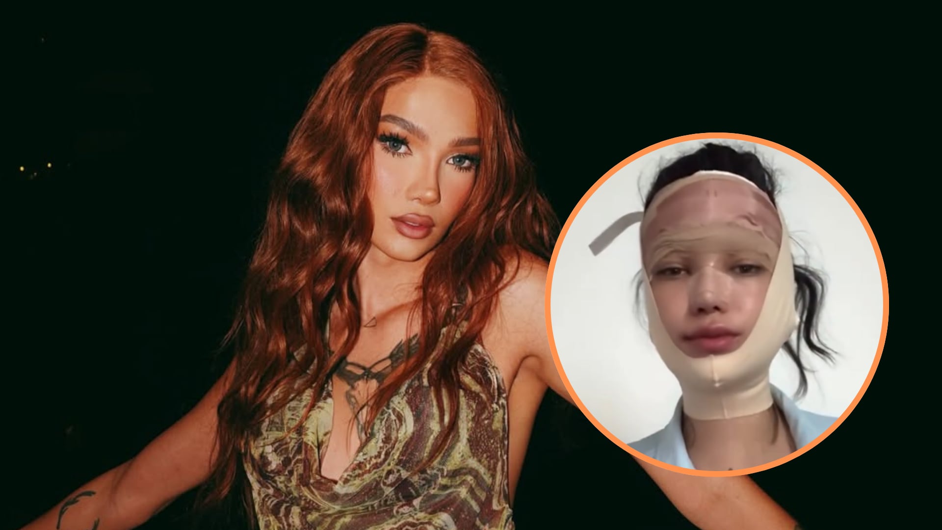 Cami Pulgarín sorprendió al mostrar los resultados de operación de cambio extremo: “Tiene una cara nueva”