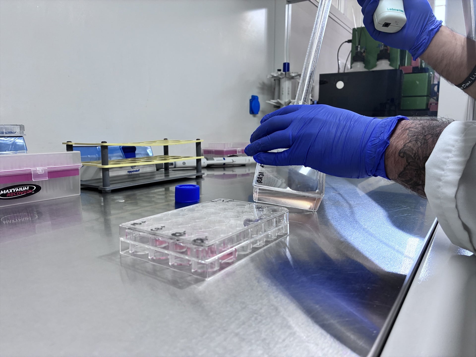 Las células T recolectadas se someten a controles de calidad antes de enviarlas a laboratorios dotados de tecnología avanzada para su modificación genética (Europa Press)
