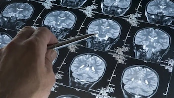 Un estudio reveló qué tipo de deportistas tienen cuatro veces más riesgo de morir por enfermedades neurodegenerativas