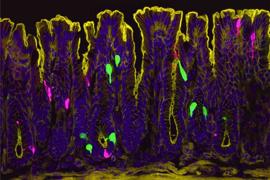 El estrógeno puede provocar que ciertas células del colon, mostradas en verde en esta imagen microscópica, liberen una hormona llamada péptido YY. Esto, a su vez, provoca que un tipo diferente de célula del colon, de color magenta, produzca serotonina, el mensajero químico que activa las fibras nerviosas sensibles al dolor