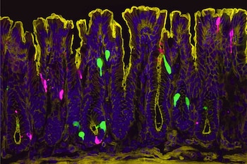 El estrógeno puede provocar que