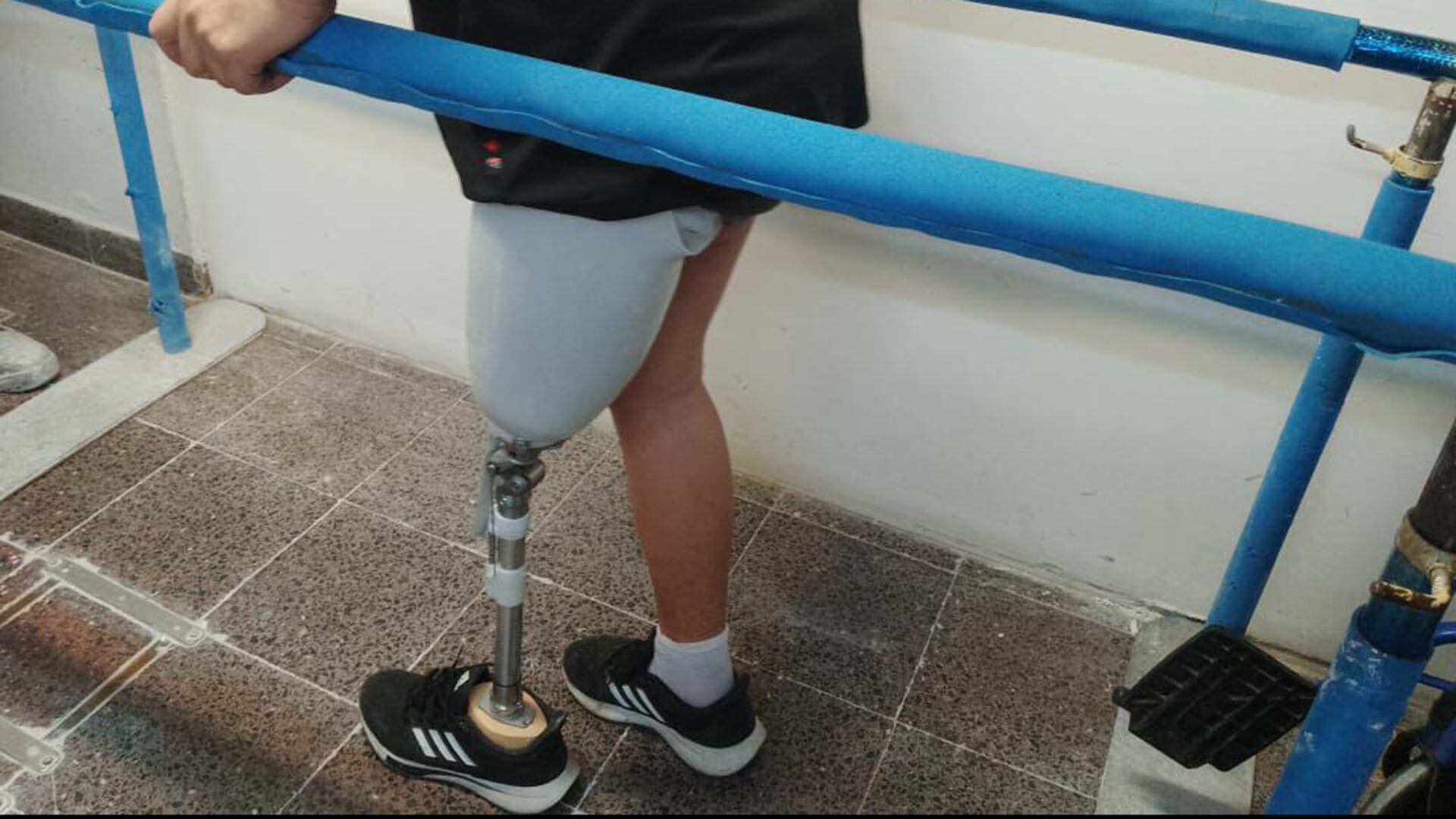 Brian fue arrollado por un tren cuando tenía 9 años y le amputaron media pierna