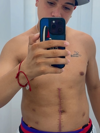 A un año del accidente que casi se cobra su vida, Thiago Medina hizo un posteo en sus redes sociales (Instagram)