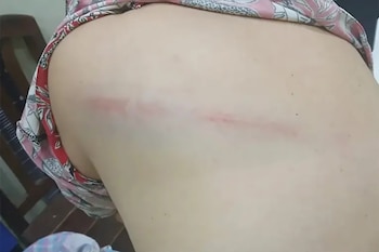 Así quedó la espalda de