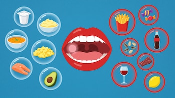 Extracción dental: qué alimentos no se deben comer y cuáles recomiendan los odontólogos