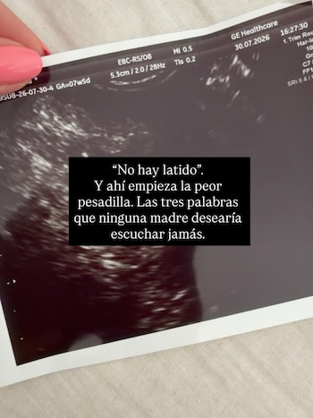 Marta Sanahuja ha compartido con sus seguidores que ha sufrido un aborto. (Instagram @deliciousmartha)