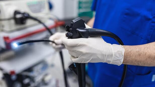 La mayoría de los pólipos de colon no presentan síntomas y suelen detectarse durante exámenes de rutina como la colonoscopia.(Freepik)