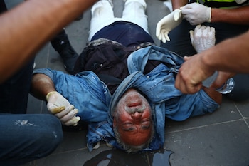 Imagen GYQ5K2BVSE6EEI2SIJXOLI4M6M