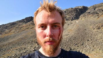 Francis Ari Sture, unas de