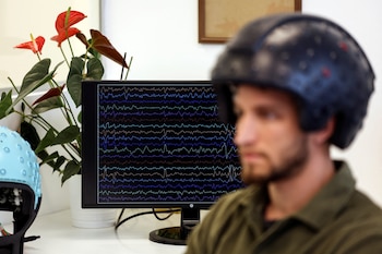 Estudios previos del locus coeruleus,