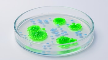 Una placa de Petri con colonias celulares grandes de color verde fluorescente y colonias celulares pequeñas de color azul cielo sobre una mesa blanca.