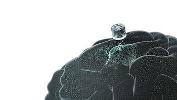 implante cerebral - depressão - humano - cérebro - tecnologia - 29 de abril
