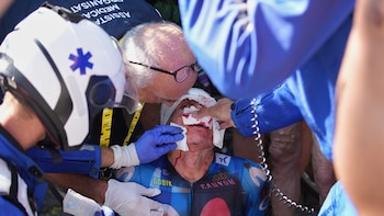Escandaloso accidente en el Tour de France: un ciclista chocó contra un auto que frenó de golpe, recibió 20 puntos en el rostro y abandonó la carrera