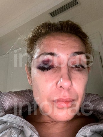 Otra imagen de Fabiola con