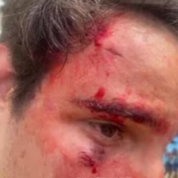 Así terminó uno de los