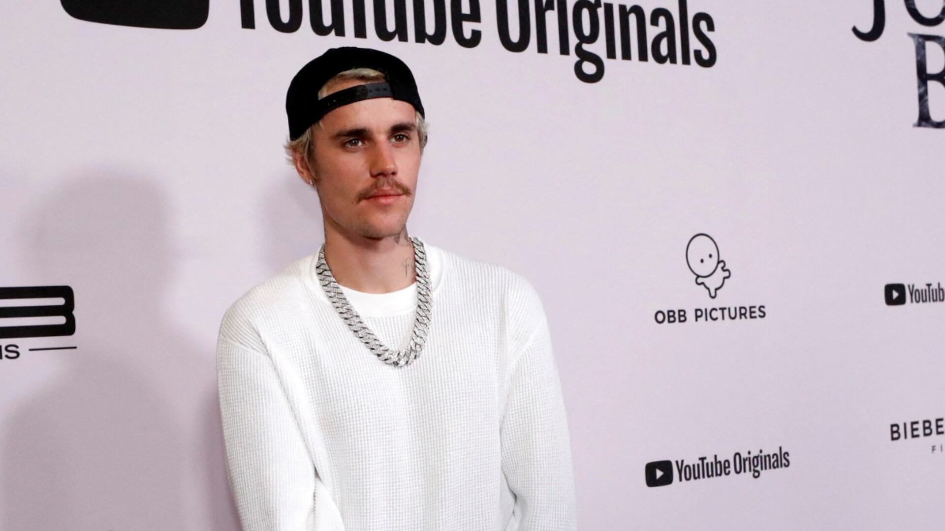 Justin Bieber confesó que sufrió una severa lesión. (REUTERS/Mario Anzuoni)