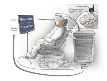 Ilustración de una persona en silla de ruedas frente a una pantalla, con implantes cerebrales conectados a un equipo de procesamiento de datos