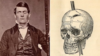 Una barra de hierro le