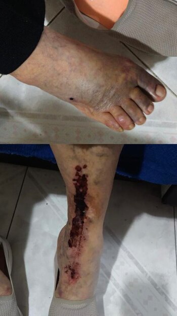 La víctima, arrollada en Iztacalco,