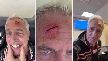 Marley se golpeó la cabeza en una panadería y tuvieron que coserlo en un hospital: "Premio al bolu del año"
