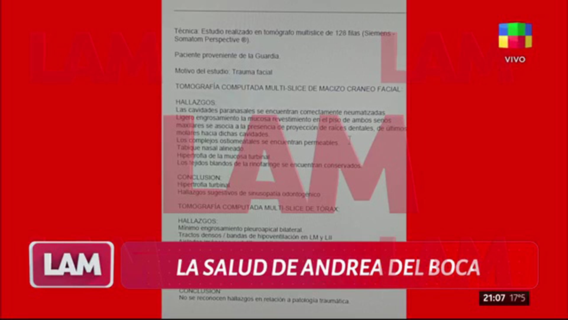 El conductor Ángel de Brito, remarcó la sorpresa del equipo al conocer la elección de “María del B” como identificación oficial durante la atención médica