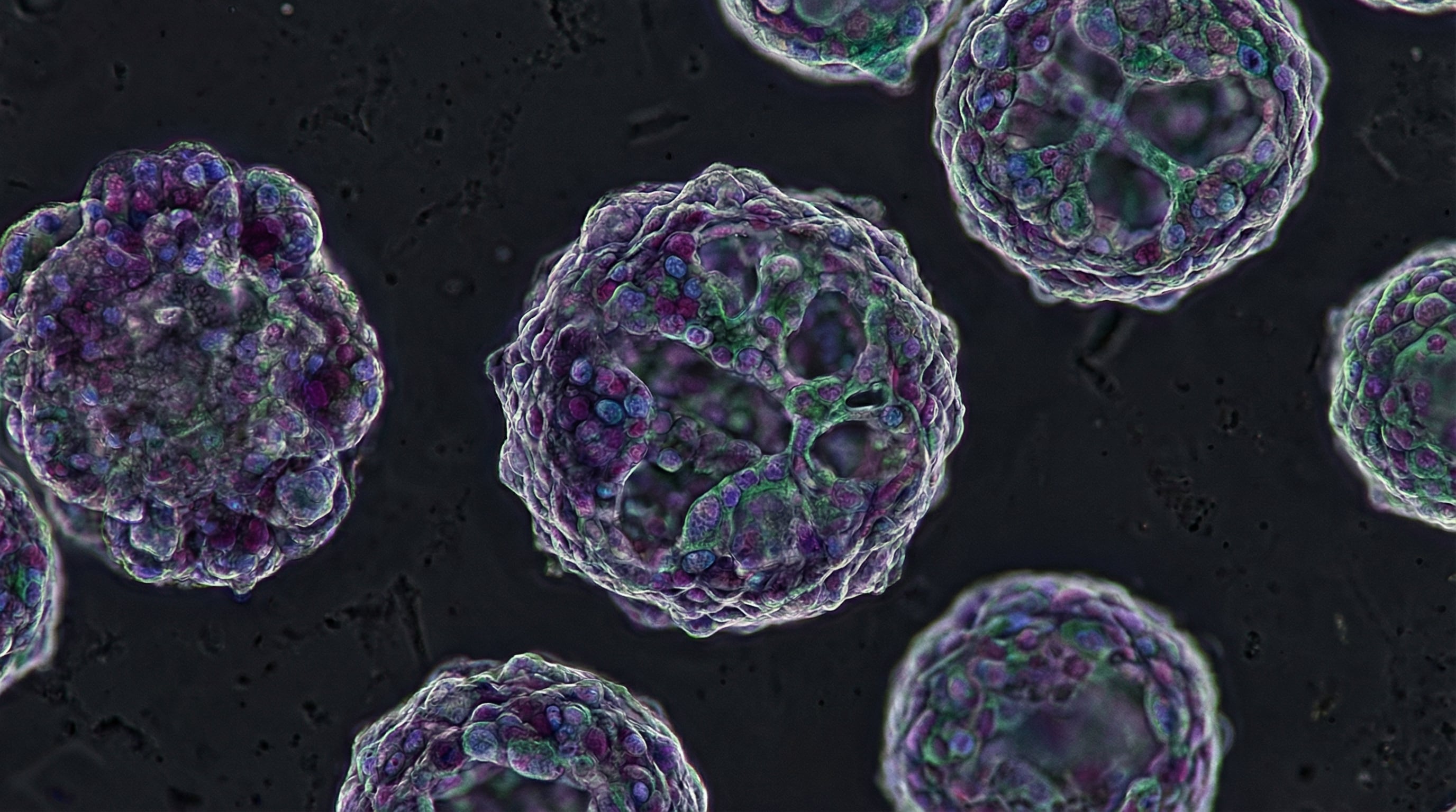 Los organoides cerebrales registraron el paso del tiempo y conservaron memoria celular de su edad de desarrollo durante el experimento (Imagen Ilustrativa Infobae)