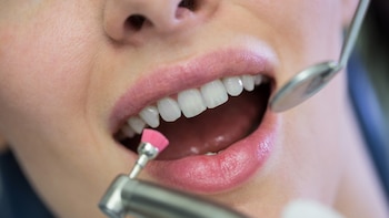 Azúcar y caries: cómo los