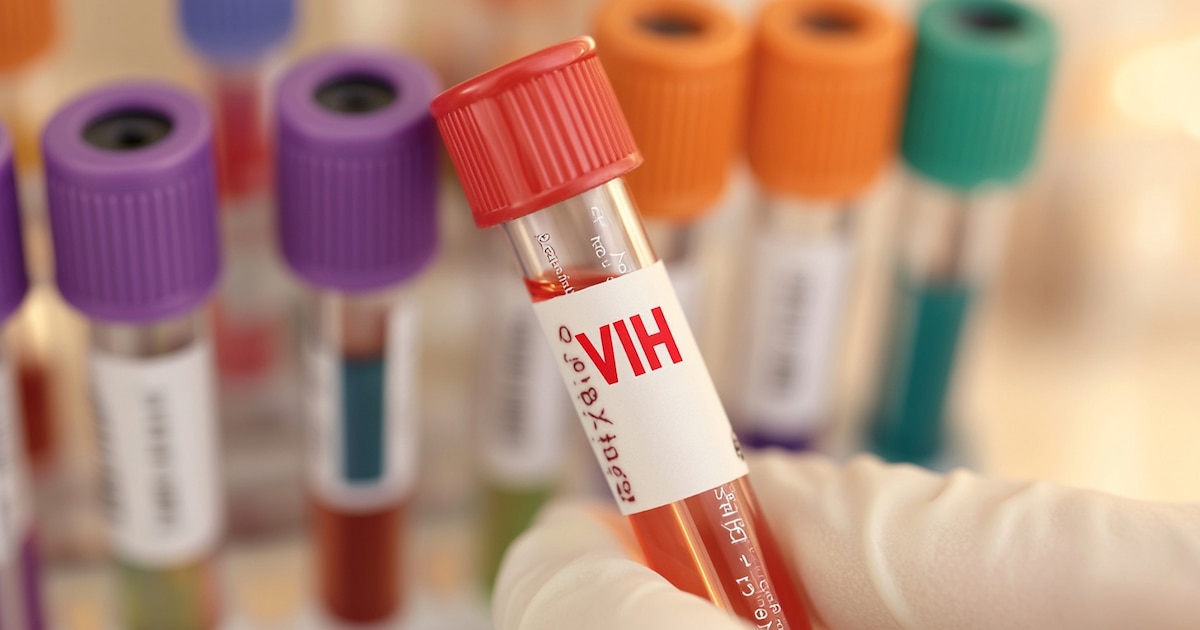 ¡Alivio para Pacientes! El Ministerio de Salud Elimina Trámites Engorrosos para Tratamientos de Cáncer y VIH en Colombia