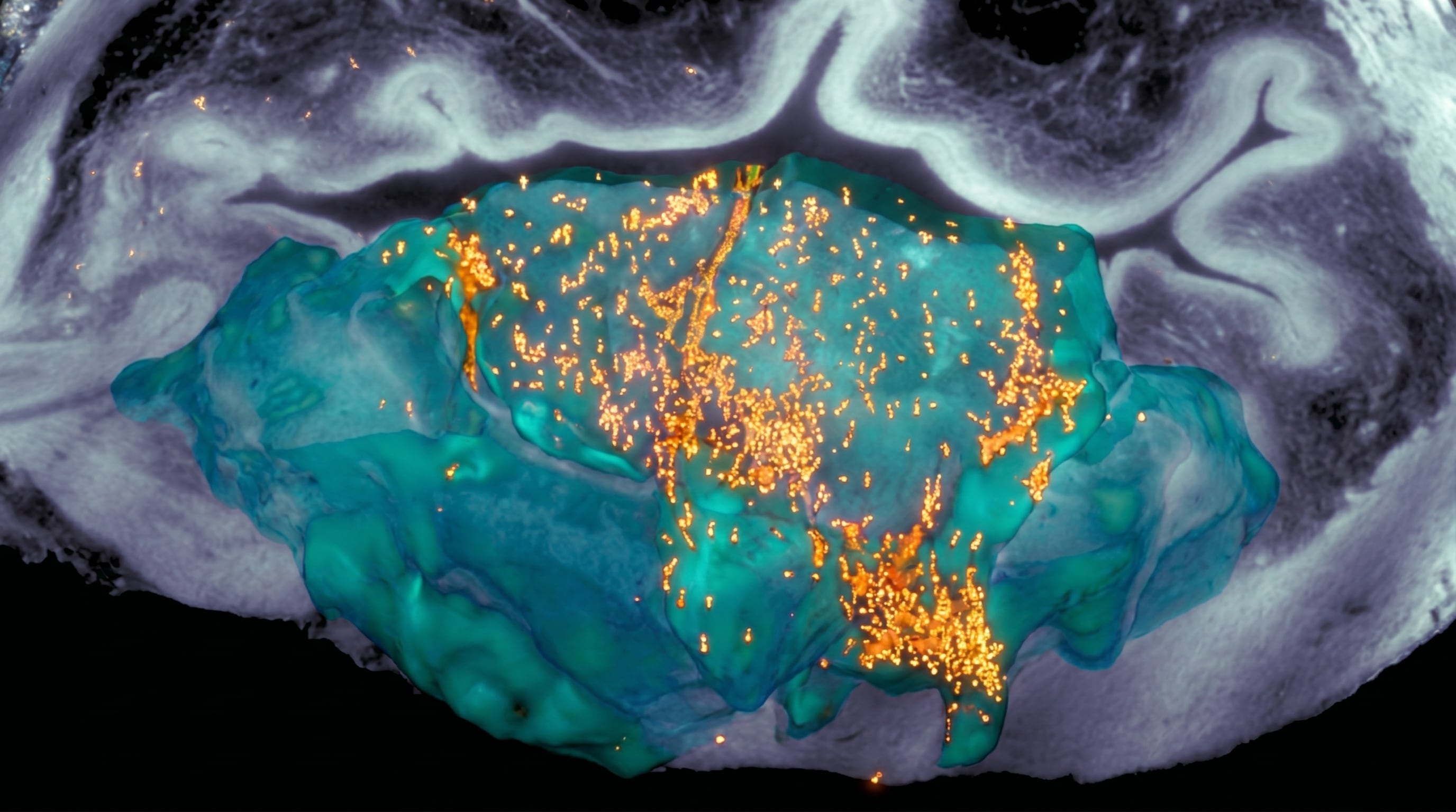 Esta imagen ilustrativa muestra la acumulación de nanorobots, representados por puntos luminosos naranjas, en un tumor de la vejiga urinaria, visualizados mediante microscopía para investigar nuevas terapias contra el cáncer. (Imagen Ilustrativa Infobae)