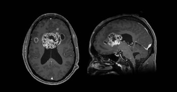 La tomografía que detectó el