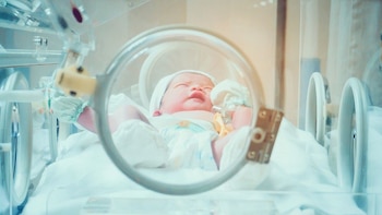 ¿Podría un bajo peso al nacer aumentar las probabilidades de un AVC temprano?