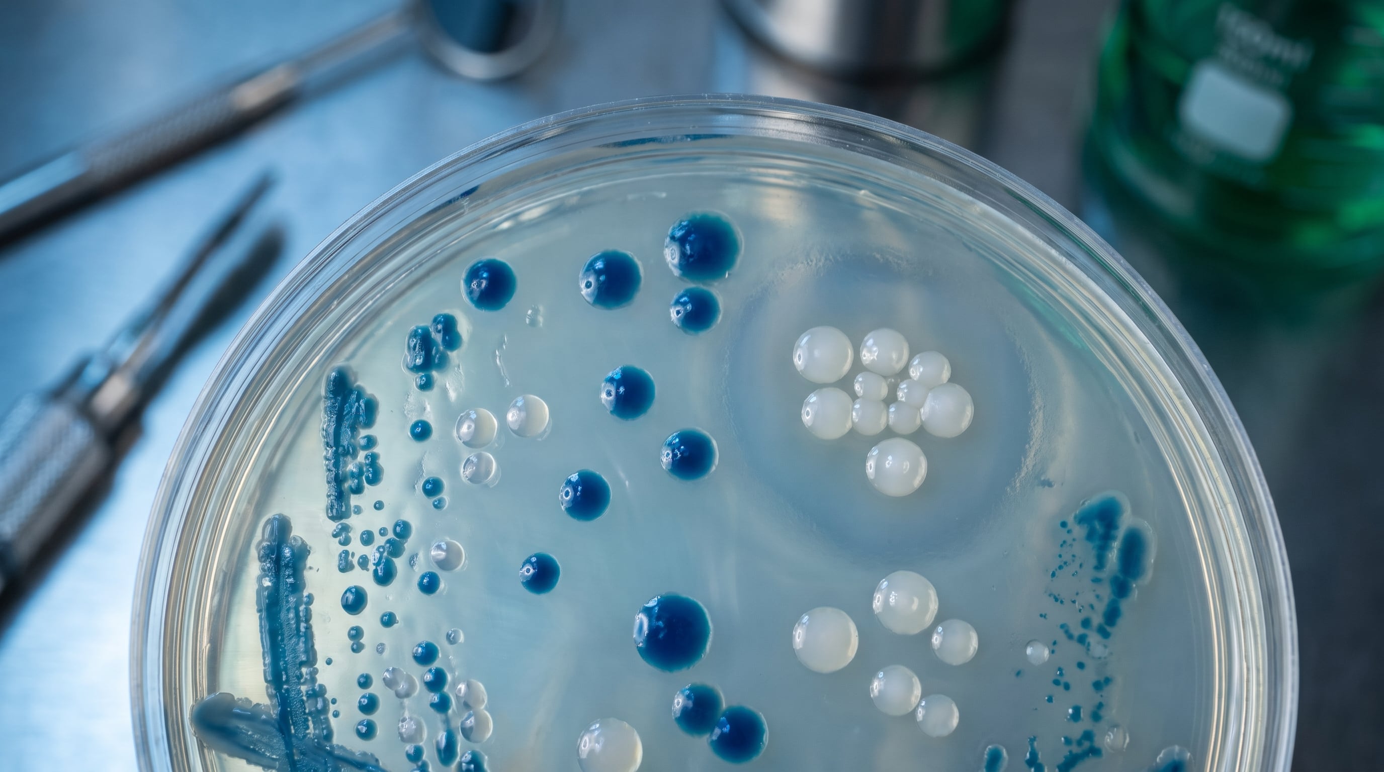 Las respuestas inmunitarias frente a bacterias encapsuladas como Streptococcus pneumoniae descendieron de manera gradual hacia la fase clínica. (Imagen Ilustrativa Infobae)