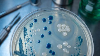 Placa de Petri con colonias de bacterias de color azul y blanco. En el fondo, instrumentos de laboratorio desenfocados.
