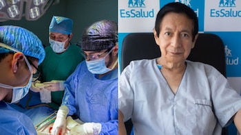 Exitosa doble cirugía salva a paciente de 74 años con aneurisma de aorta