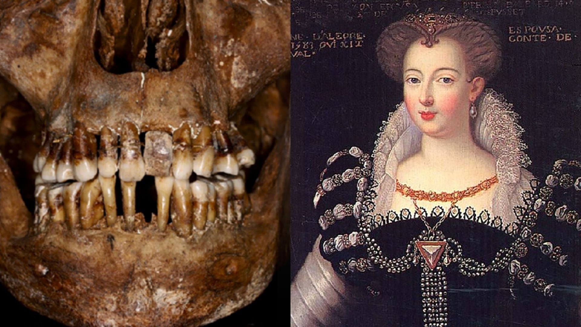 Imagen de la mandíbula de la aristócrata Anne d'Alègre (Journal of Archaeological Science: Reports / Wikimmedia Commons)
