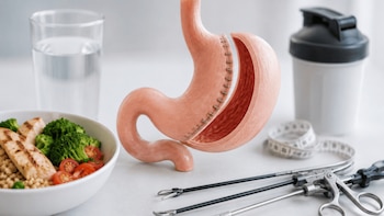 Un modelo anatómico de estómago suturado junto a instrumentos quirúrgicos, un plato con comida, un vaso de agua y una cinta métrica