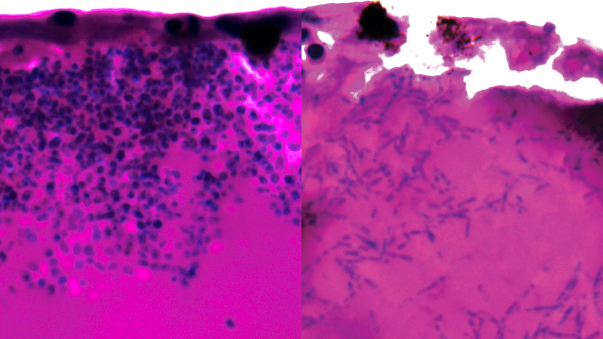 Los científicos capturaron la imagen de los filamentos del hongo Candida auris durante la fase de infección (Universidad de Exeter)