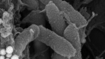 El peligro de las súper