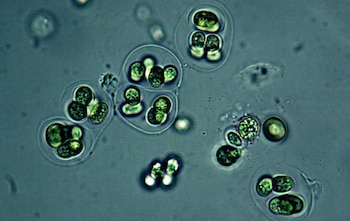 Microbiota intestinal, uno de los