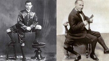 La increíble vida del hombre