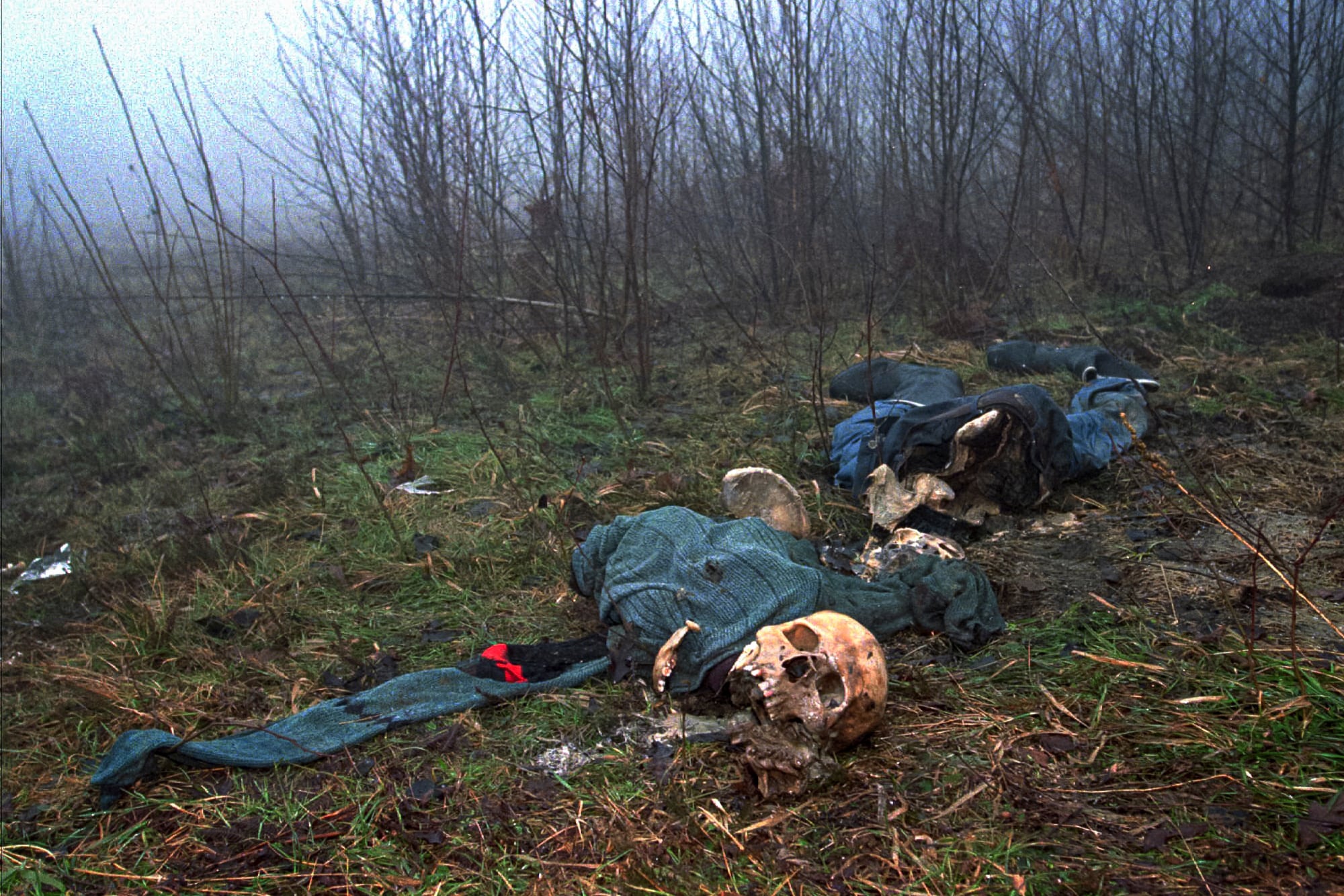 Cuatro esqueletos vestidos encontrados en la cima de una colina alrededor de Srebrenica en una foto del 4 de febrero de 1996 (AP Photo/Alexander Zemlianichenko, archivo)
