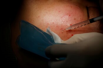 El spa fue clausurado en