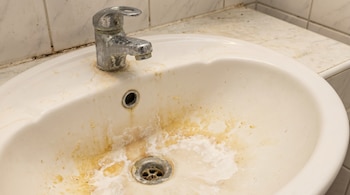Lavabo de baño blanco muy sucio con grifo de metal cubierto de sarro y manchas de óxido. El desagüe y la superficie están cubiertos de suciedad y moho.