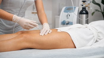 Carboxiterapia: qué es, para qué sirve y cuáles son sus posibles riesgos